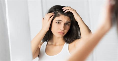 Tips to Prevent Recurrence of Dandruff