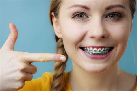 Traditional Braces: Tried and True