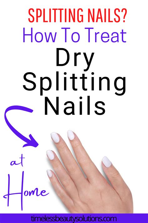 Treating Split Nails: Effective Remedies for Promoting Healthy Nail Recovery