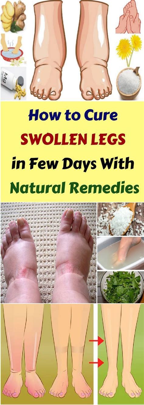 Treating Swollen Legs: Medical Interventions