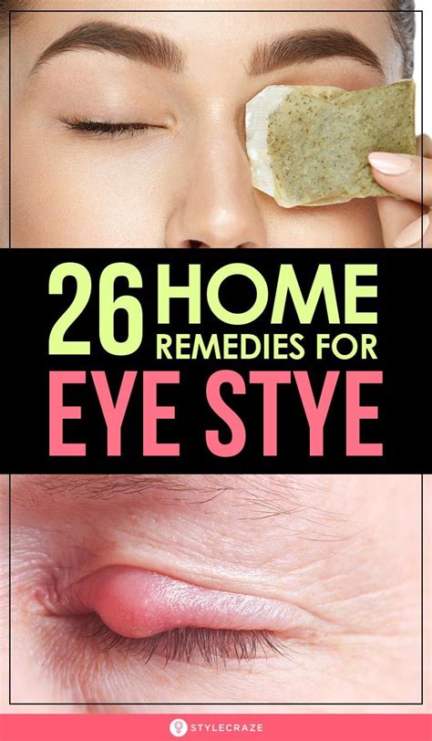 Treating a Swollen Eye: Home Remedies and Medical Interventions