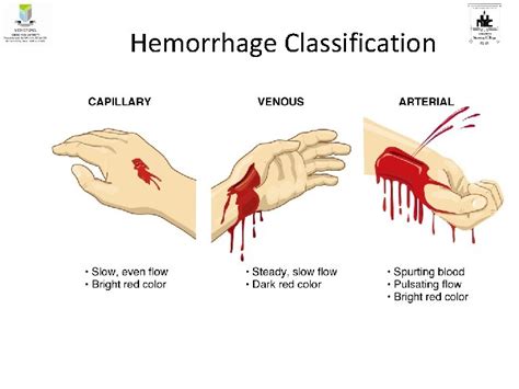 Uncovering the Cryptic Significance of Visions Portraying a Hemorrhaging Throat