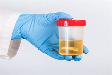 Understanding Bilirubin and Its Impact on Urine Color