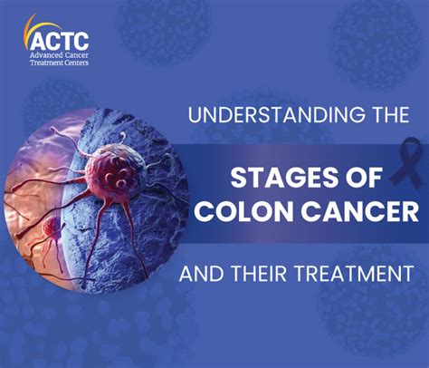 Understanding Bowel Cancer Development