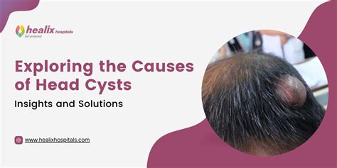 Understanding Cysts on the Scalp: An Insight into Causes, Manifestations, and Effective Approaches