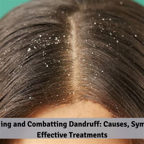 Understanding Dandruff: Causes, Symptoms, and Treatments