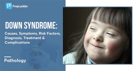 Understanding Down Syndrome: Causes, Symptoms, and Diagnosis