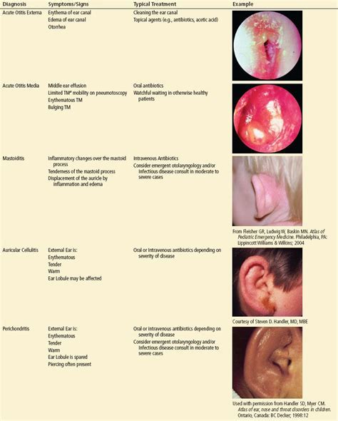 Understanding Ear Infection: Essential Information You Should Be Aware Of