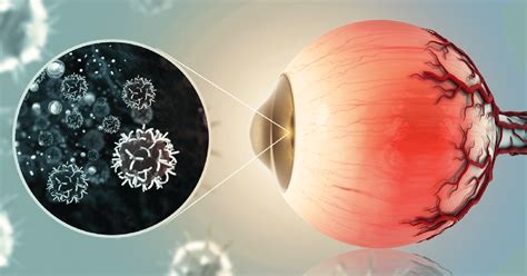 Understanding Eye Cancer: A Rare but Serious Condition