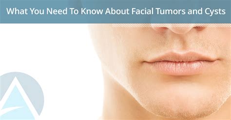 Understanding Facial Cysts: What You Need to Know