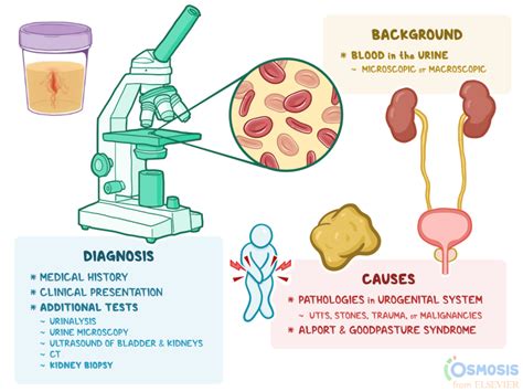 Understanding Hematuria