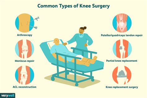 Understanding Knee Surgery: Types and Procedures