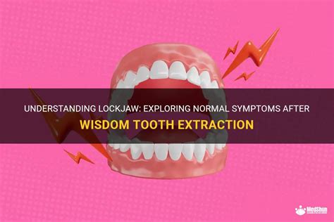 Understanding Lock Jaw: Causes and Symptoms