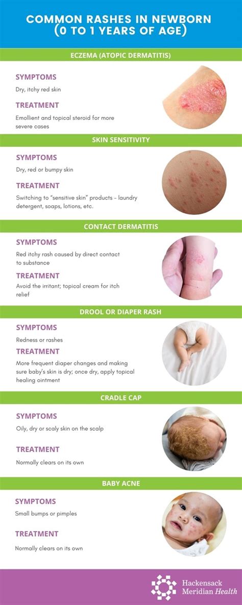 Understanding Rashes: An Overview of Common Skin Conditions