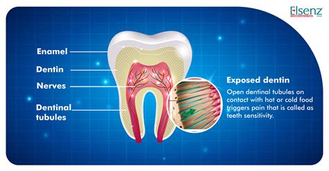 Understanding Tooth Sensitivity: Enamel and Nerve Responses