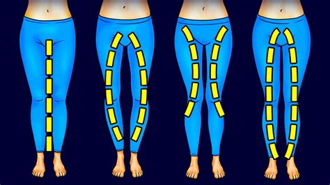 Understanding Your Leg Shape: Identifying Your Areas of Concern