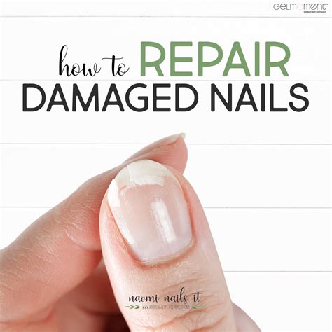 Understanding and Responding to Dreams about Damaged Nails