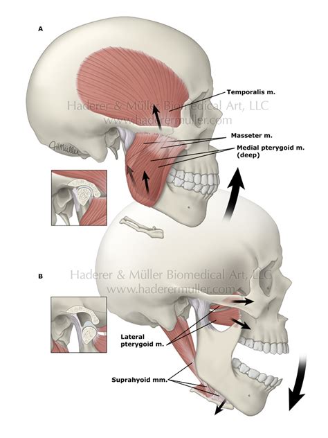 Understanding the Anatomy of the Jaw: Key Contributor to Discomfort