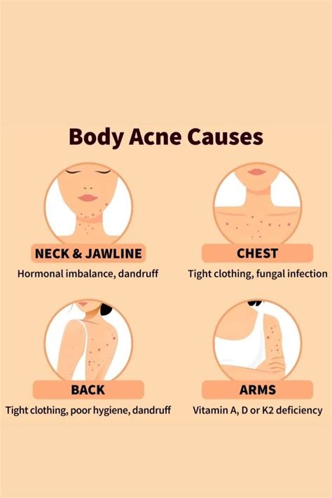 Understanding the Causes of Back Acne: From Hormonal Imbalances to Sweat Buildup