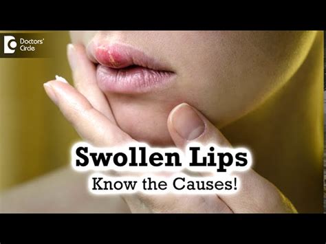 Understanding the Common Triggers of Moist Lips