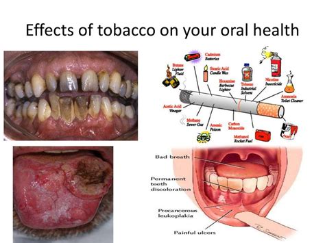 Understanding the Effects of Tobacco Use on Gum Health