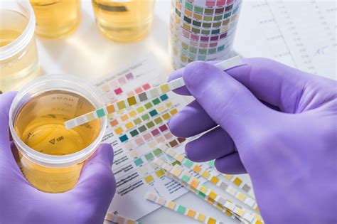 Understanding the Factors Behind Urine Discoloration