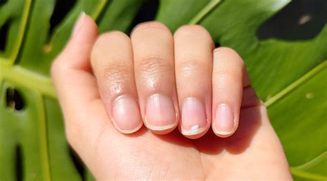 Understanding the Fundamentals of Nail Health