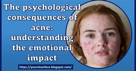 Understanding the Impact of Acne Dreaming on Mental Well-being