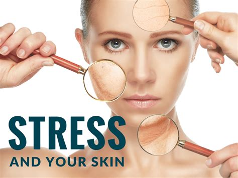 Understanding the Impact of Stress on Your Skin