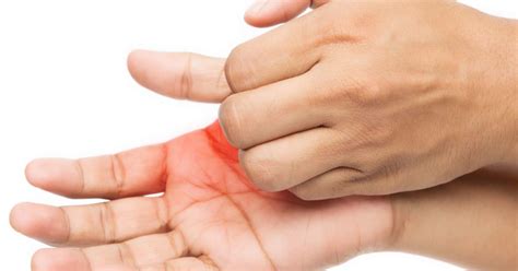 Understanding the Meaning Behind an Itchy Palm