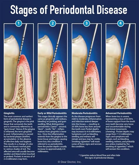 Understanding the Origins of Periodontal Issues