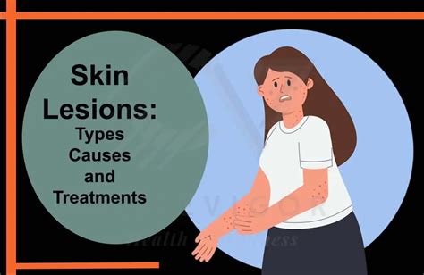 Understanding the Origins of Skin Lesions: Investigating Causal Factors