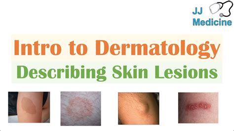 Understanding the Psychological Significance of Dreaming about Dermatological Lesions