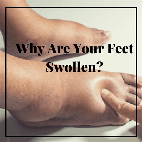 Understanding the Root Causes: Why do Feet Swell?