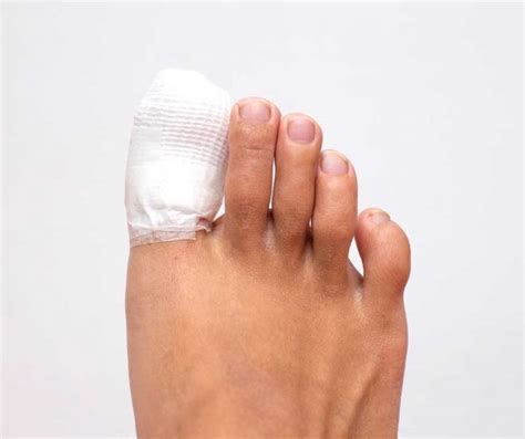 Understanding the Roots of Toenail Removal Dreams