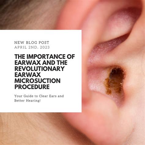 Understanding the Significance of Earwax: An In-Depth Exploration