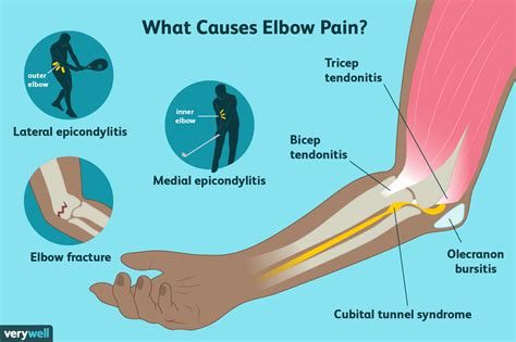 Understanding the Significance of Elbow Well-being