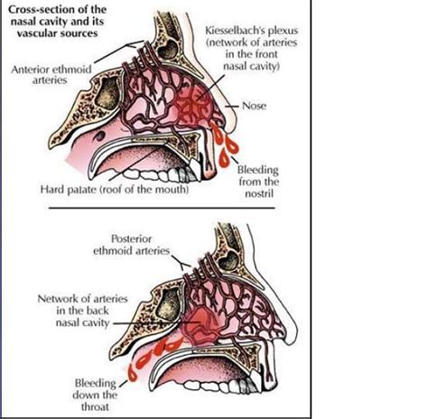 Understanding the Significance of Nasal Blood Clot Dreams: Reasons, Explanations, and Solutions