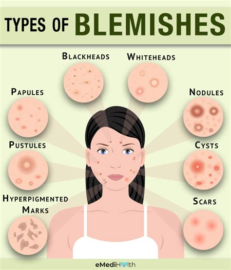 Understanding the Significance of Popping Blemishes: Interpretations and Consequences