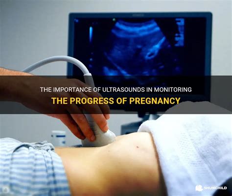 Understanding the Significance of Ultrasound in Pregnancy