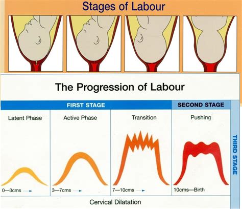 Understanding the Stages of Labor: From Contractions to Delivery