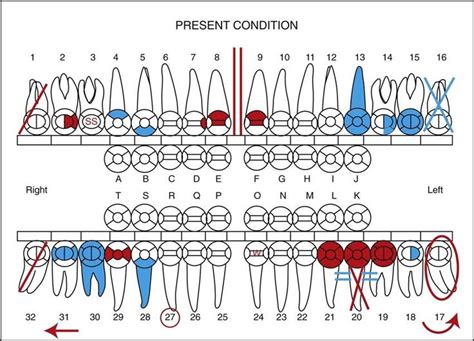 Understanding the Symbolic Significance of Dental Imbalances