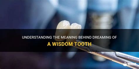 Understanding the Symbolism Behind Dreaming About Damaged Teeth