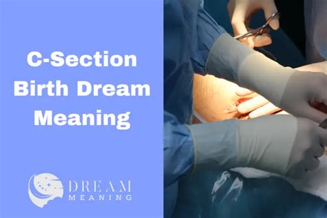 Understanding the Symbolism of Dreaming about a C-Section