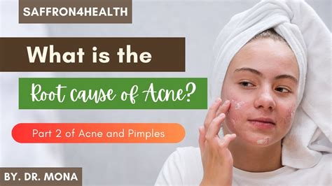 Understanding the Underlying Factors of Severe Acne