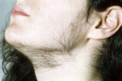 Unlocking the Symbolic Significance of a Hirsute Visage