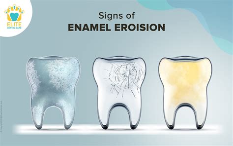 Unraveling the Factors contributing to Enamel Erosion