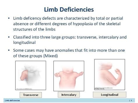 Unraveling the Significance: The Missing Limbs and its Psychological Interpretation