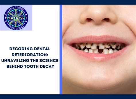 Unraveling the Symbolism Behind Dental Nightmares: Decoding the Meaning of Nightly Tooth Decay