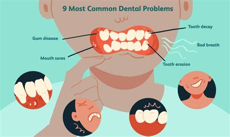 Unresolved Dental Issues: Could Dental Problems Be the Cause of Such Dreams?